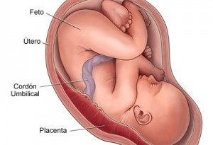 placenta-previa-2-300x300