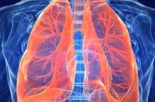 polmoni bronchite