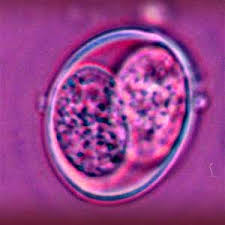 toxoplasmosi gravidanza