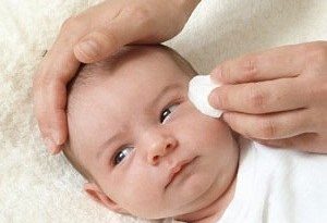 eczema neonato