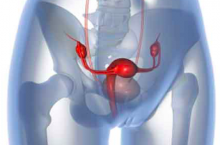 tumore utero